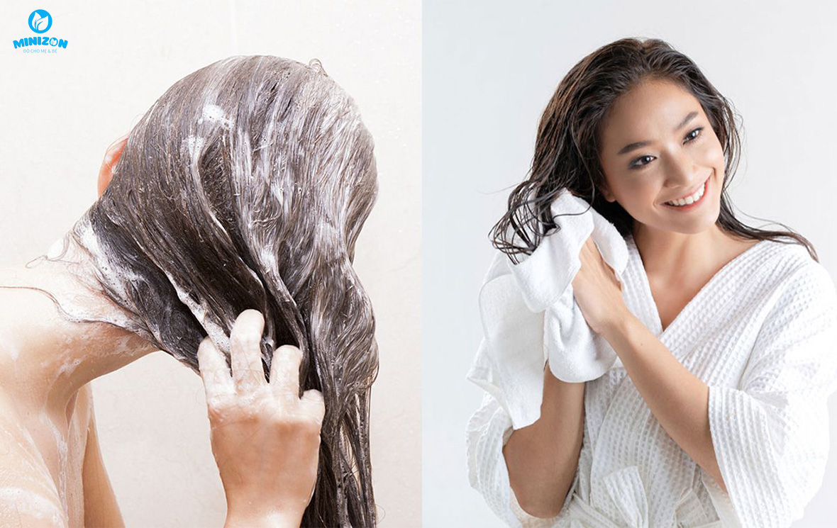 Dấu hiệu tóc rụng sau sinh ở phụ nữ Dấu hiệu tóc rụng sau sinh ở phụ nữ