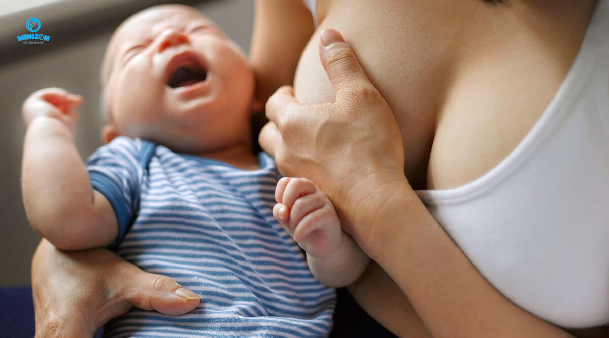 Nứt cổ gà là bệnh gì? Nứt cổ gà là bệnh gì?