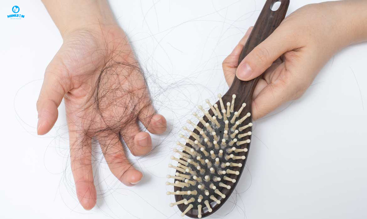 Sự thay đổi nội tiết tố làm rụng tóc sau sinh Sự thay đổi nội tiết tố làm rụng tóc sau sinh