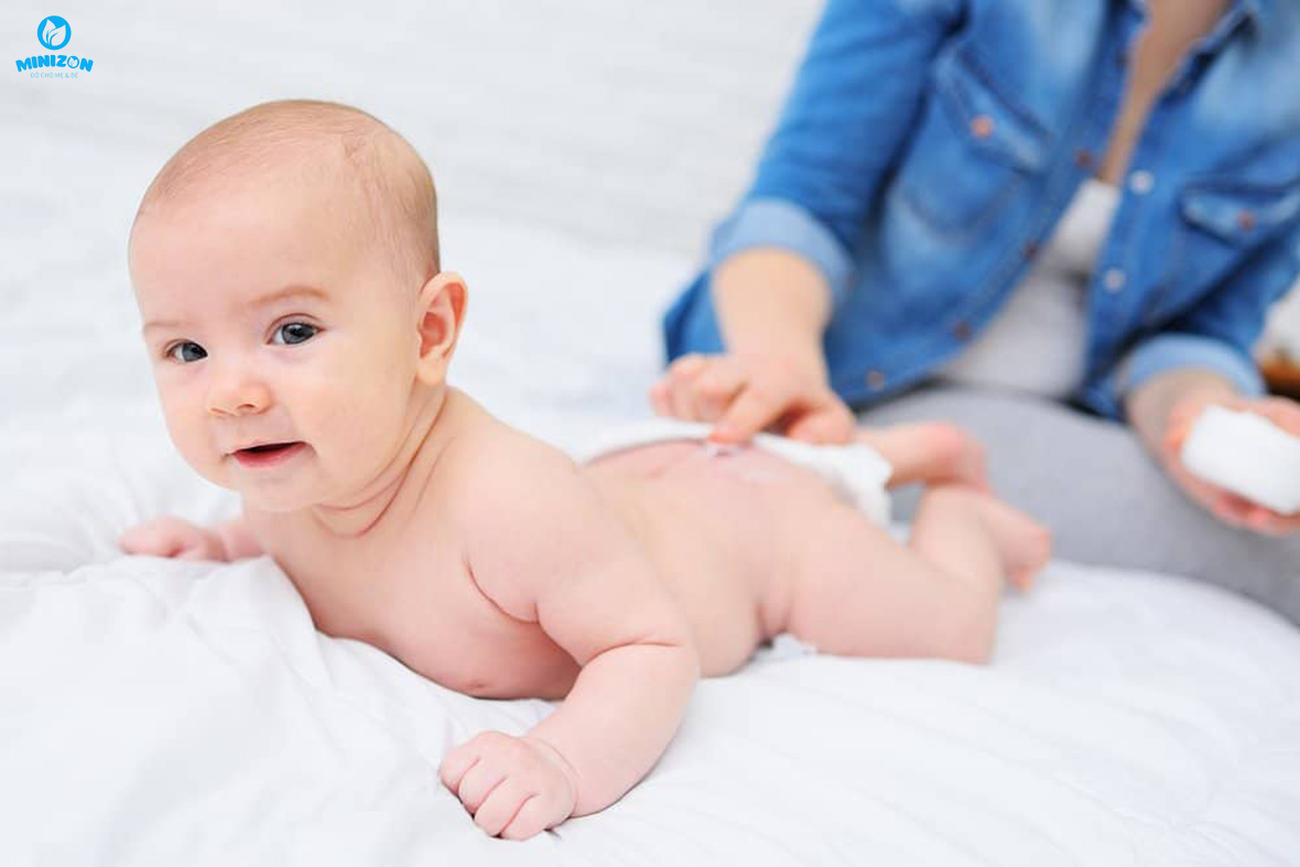 Biện pháp phòng ngừa hăm da cho trẻ nhỏ Biện pháp phòng ngừa hăm da cho trẻ nhỏ