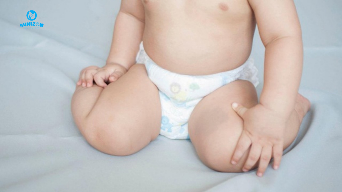 Mặc quần áo thoáng mát tránh bị hăm Mặc quần áo thoáng mát tránh bị hăm