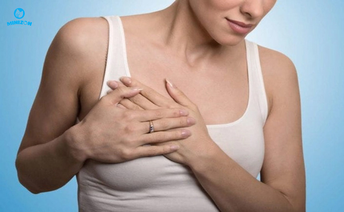 Tắc tia sữa do lựa chọn áo ngực không đúng Tắc tia sữa do lựa chọn áo ngực không đúng