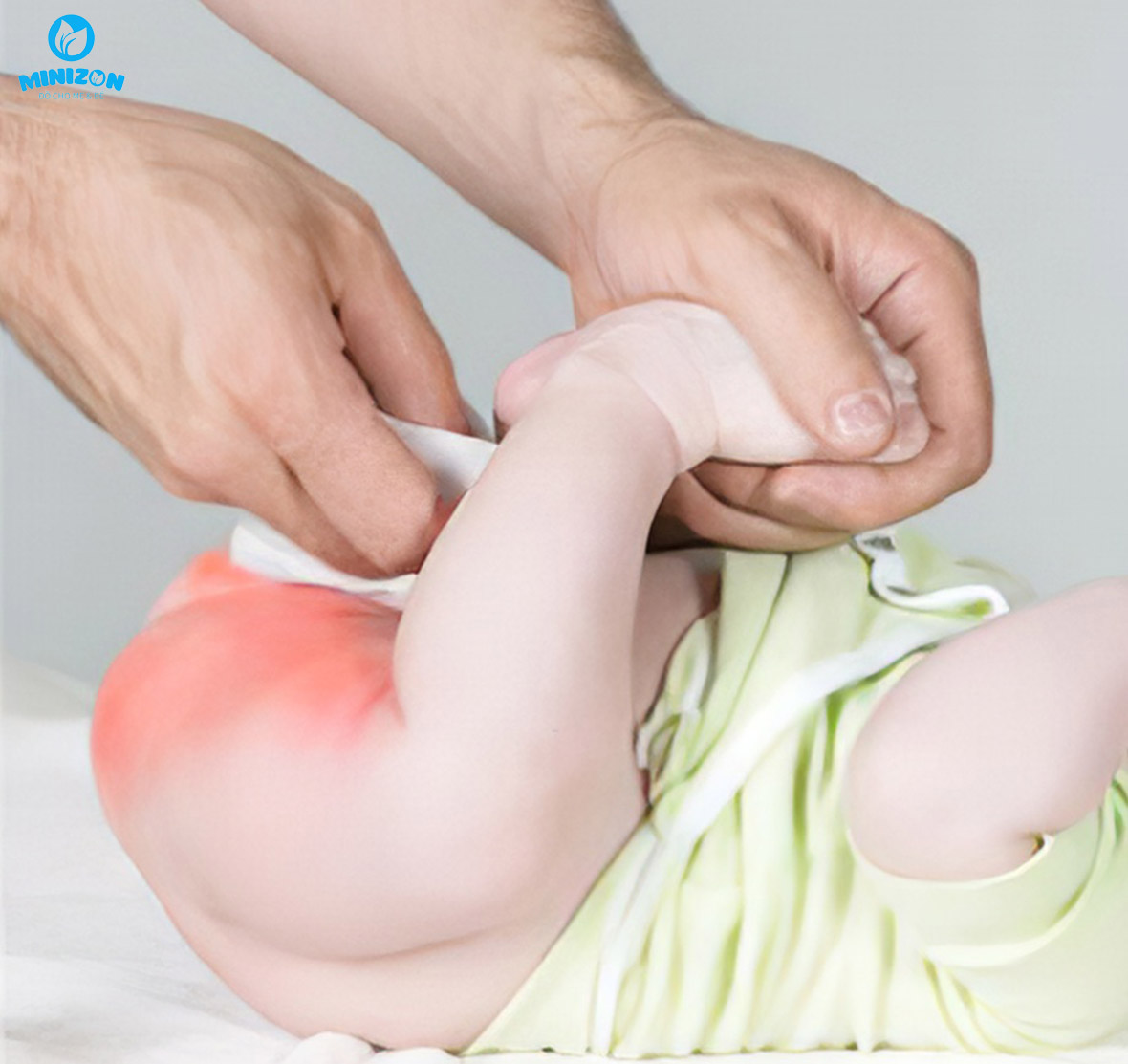 Tiếp xúc với nước gây hăm ở trẻ nhỏ Tiếp xúc với nước gây hăm ở trẻ nhỏ