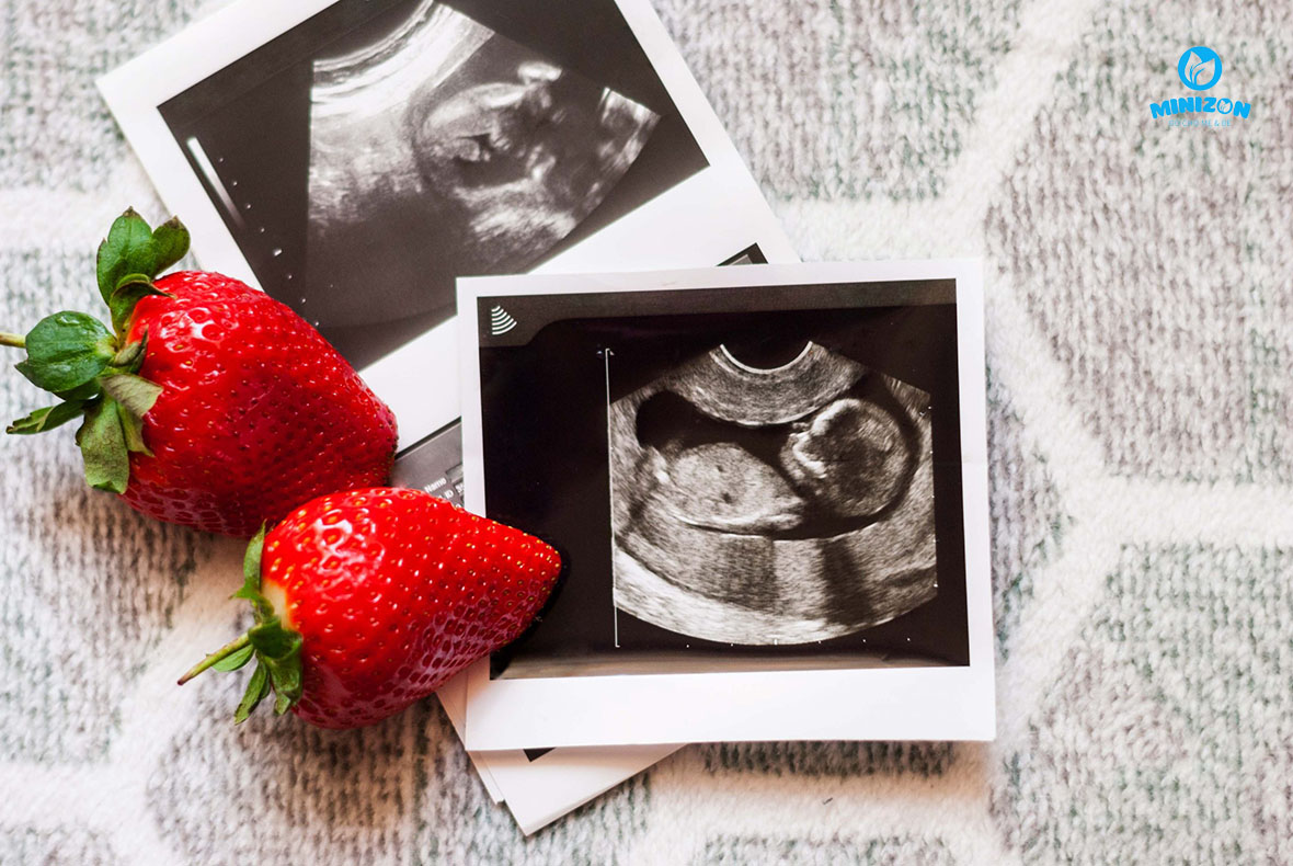 Biện pháp giúp giảm thiểu chi phí làm IVF Biện pháp giúp giảm thiểu chi phí làm IVF