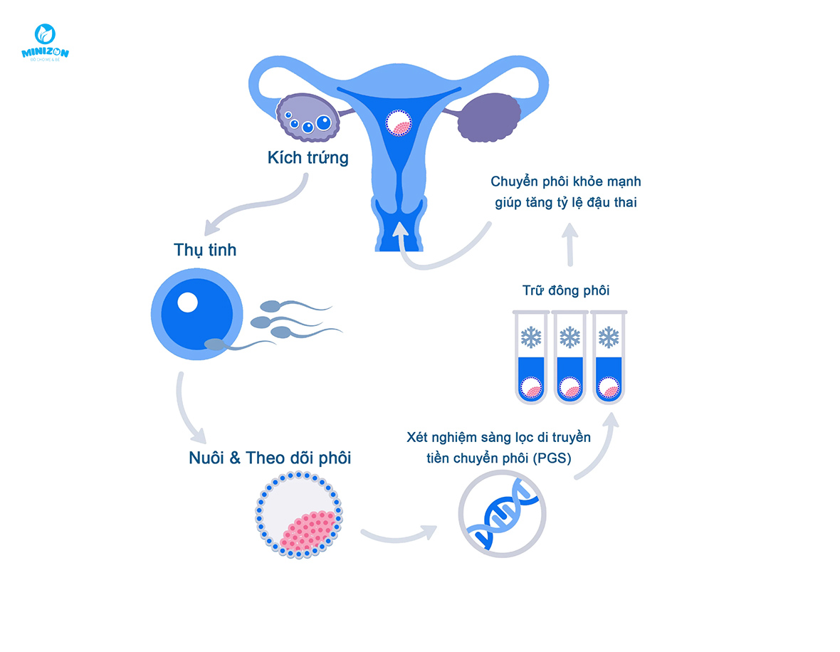 Thụ tinh ống nghiệm IVF là gì? Thụ tinh ống nghiệm IVF là gì?