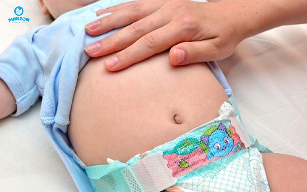 Chướng bụng Chướng bụng
